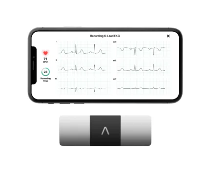 KardiaMobile 6L Personal EKG Monitor with Most Smartphones